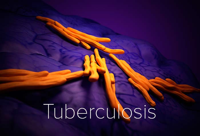 Tuberculosis Decontamination and Sterilization at Life Science Facilities in Ohio